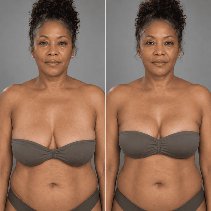 Denise, 57