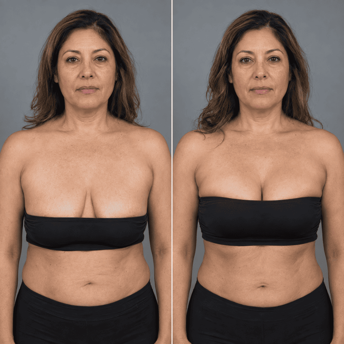 Angela, 63